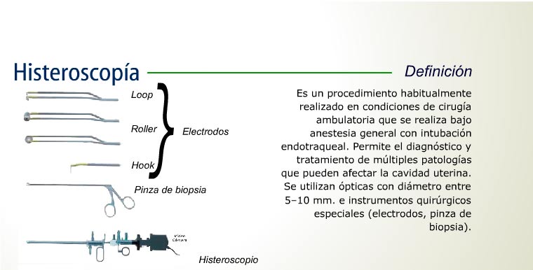 Histeroscopía